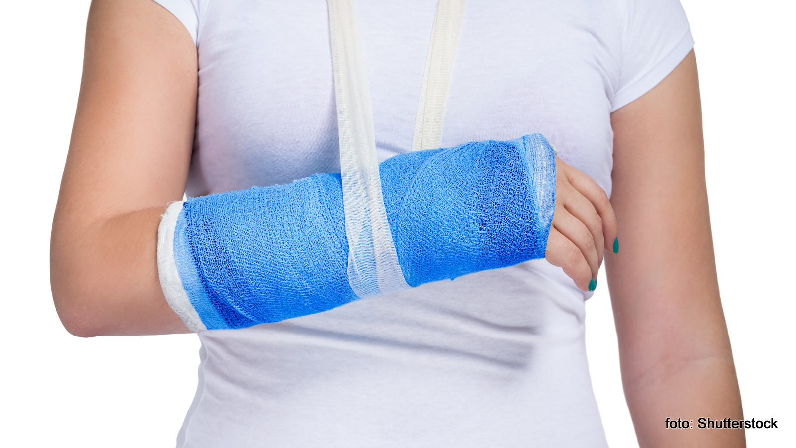 De meest voorkomende blessures tijdens paardrijden